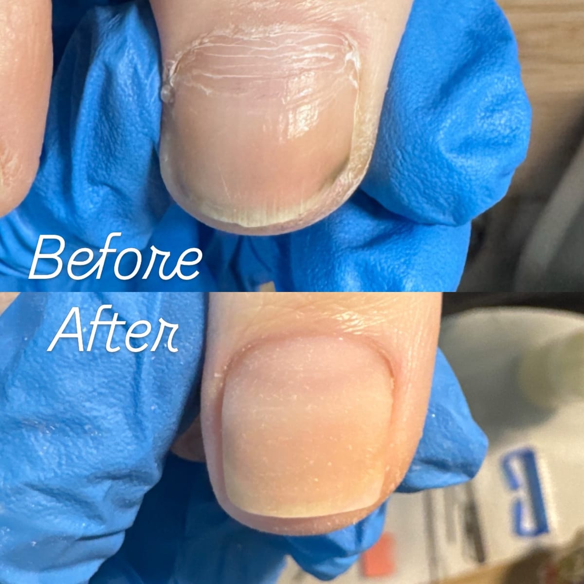 Before and after natural nail care by Shifa Nail Care