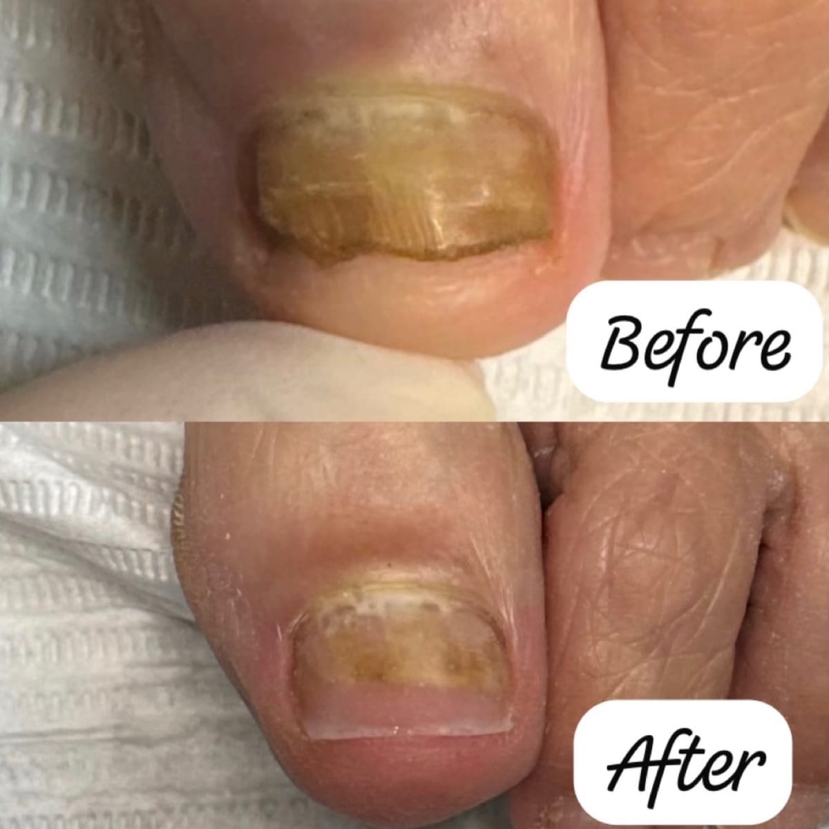 Nail restoration detail by Shifa Nail Care